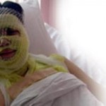 Kezzap Nedir? Kezzabın Zararları Nelerdir?