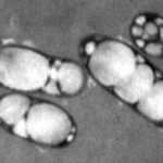 Fitohemagglutinin Sağlık Açısından Yararları ve Zararları