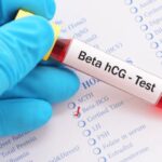 Beta HCG Nedir ve Gebelikte Önemi